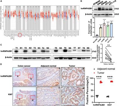 hnRNPA2B1 Promotes Colon Cancer Progression via the MAPK Pathway